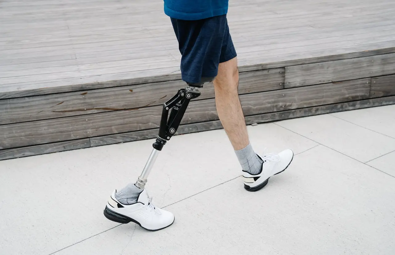 Renew Dignity: Prosthetics & Orthotics